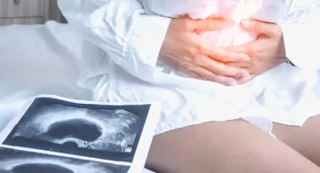 La chirurgie de l’endométriose : une expertise de la Clinique de la Muette